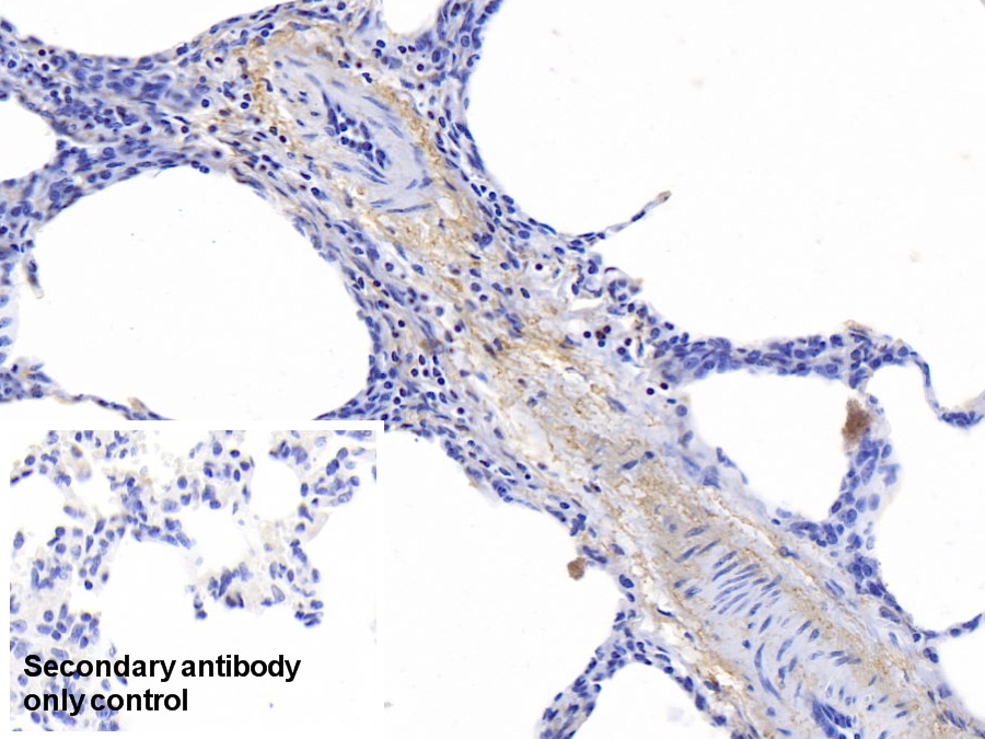 Polyclonal Antibody to Elastin (ELN)