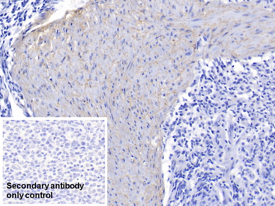 Polyclonal Antibody to Elastin (ELN)