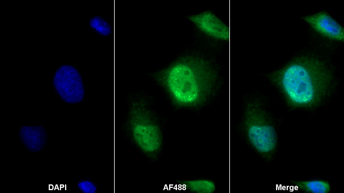 Polyclonal Antibody to Elastin (ELN)