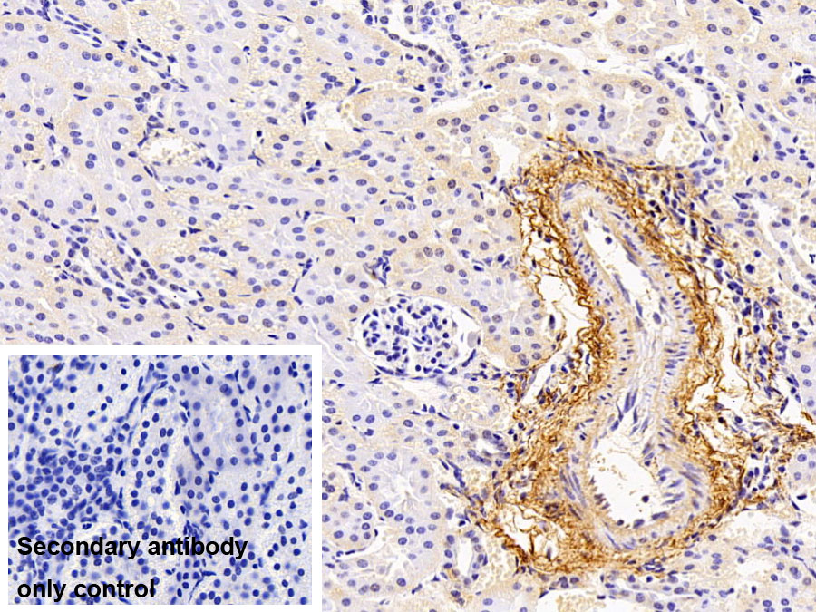 Polyclonal Antibody to Elastin (ELN)