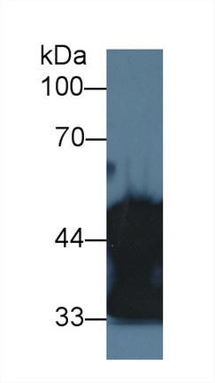 Polyclonal Antibody to Actin Alpha 2, Smooth Muscle (ACTa2)