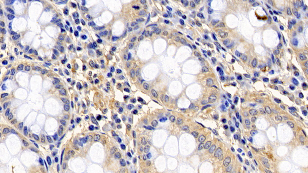 Polyclonal Antibody to Bcl2 Associated X Protein (Bax)