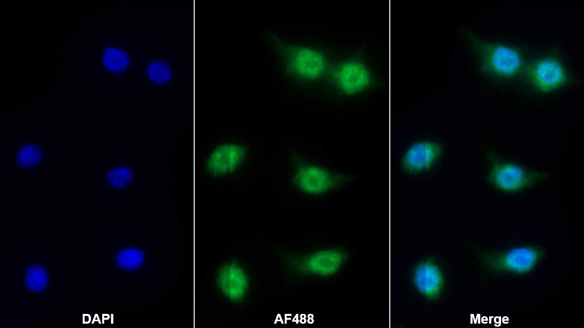 Polyclonal Antibody to Bcl2 Associated X Protein (Bax)