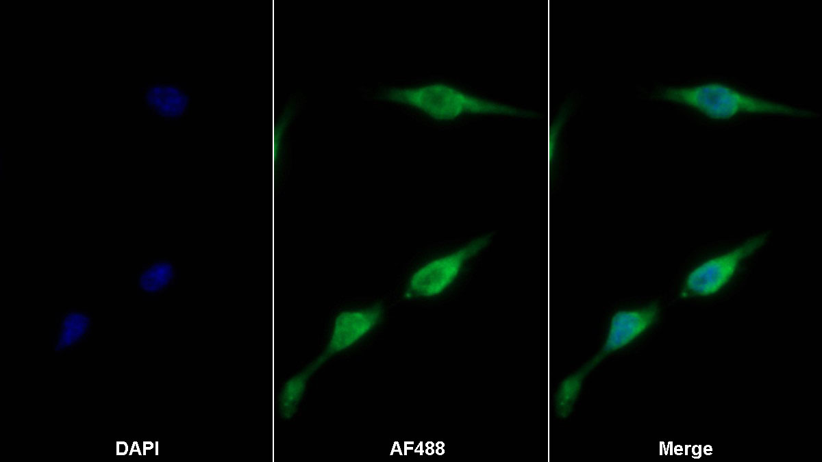 Polyclonal Antibody to Bcl2 Associated X Protein (Bax)