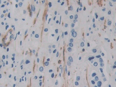 Polyclonal Antibody to Actin Gamma 2, Smooth Muscle (ACTg2)