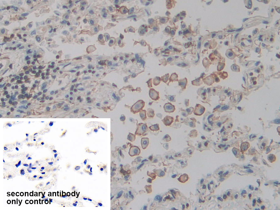 Polyclonal Antibody to Actin Gamma 2, Smooth Muscle (ACTg2)