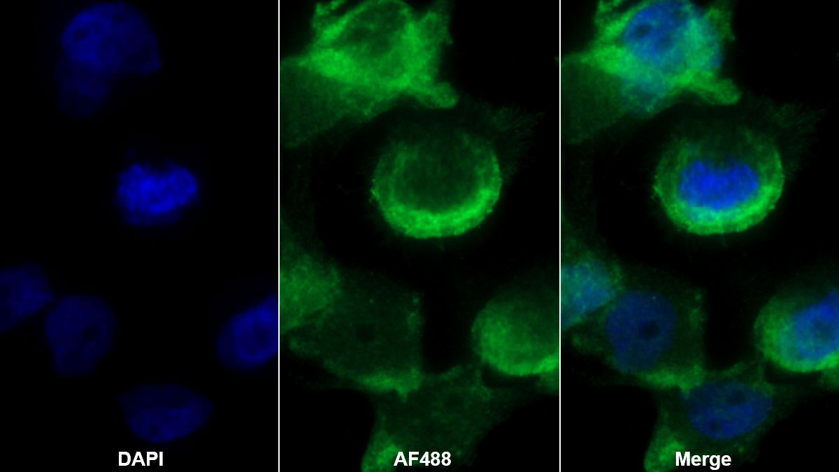 Polyclonal Antibody to Tetraspanin 30Cluster of Differentiation 63 (CD63)