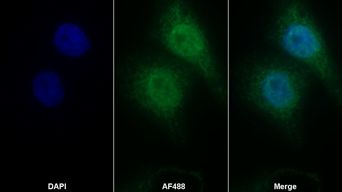 Polyclonal Antibody to Activating Transcription Factor 1 (ATF1)