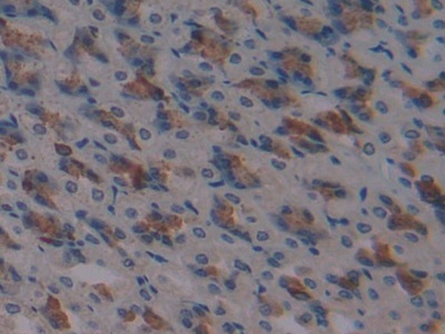 Polyclonal Antibody to Activating Transcription Factor 1 (ATF1)