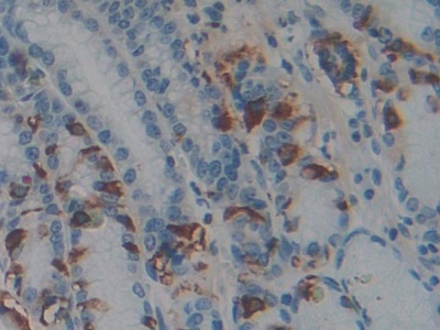 Polyclonal Antibody to Pituitary Adenylate Cyclase Activating Peptide (PACAP)