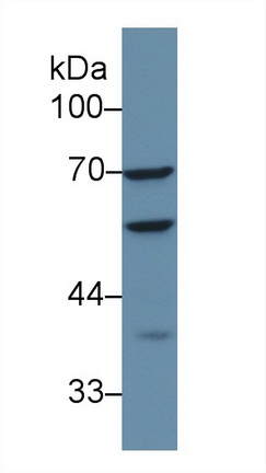 Polyclonal Antibody to Adenylyl Cyclase Associated Protein 1 (CAP1)