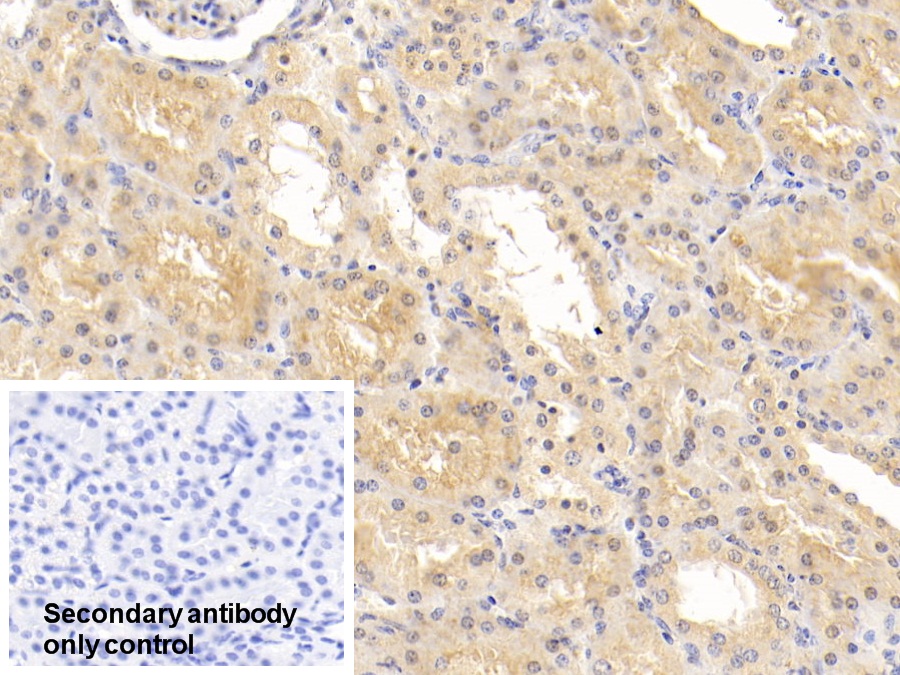 Polyclonal Antibody to Adipose Differentiation Related Protein (ADRP)