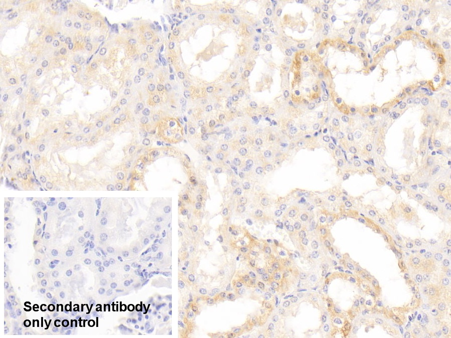 Polyclonal Antibody to Aryl Hydrocarbon Receptor (AhR)