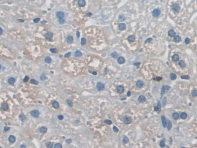 Polyclonal Antibody to Apoptosis Signal Regulating Kinase 1 (ASK1)