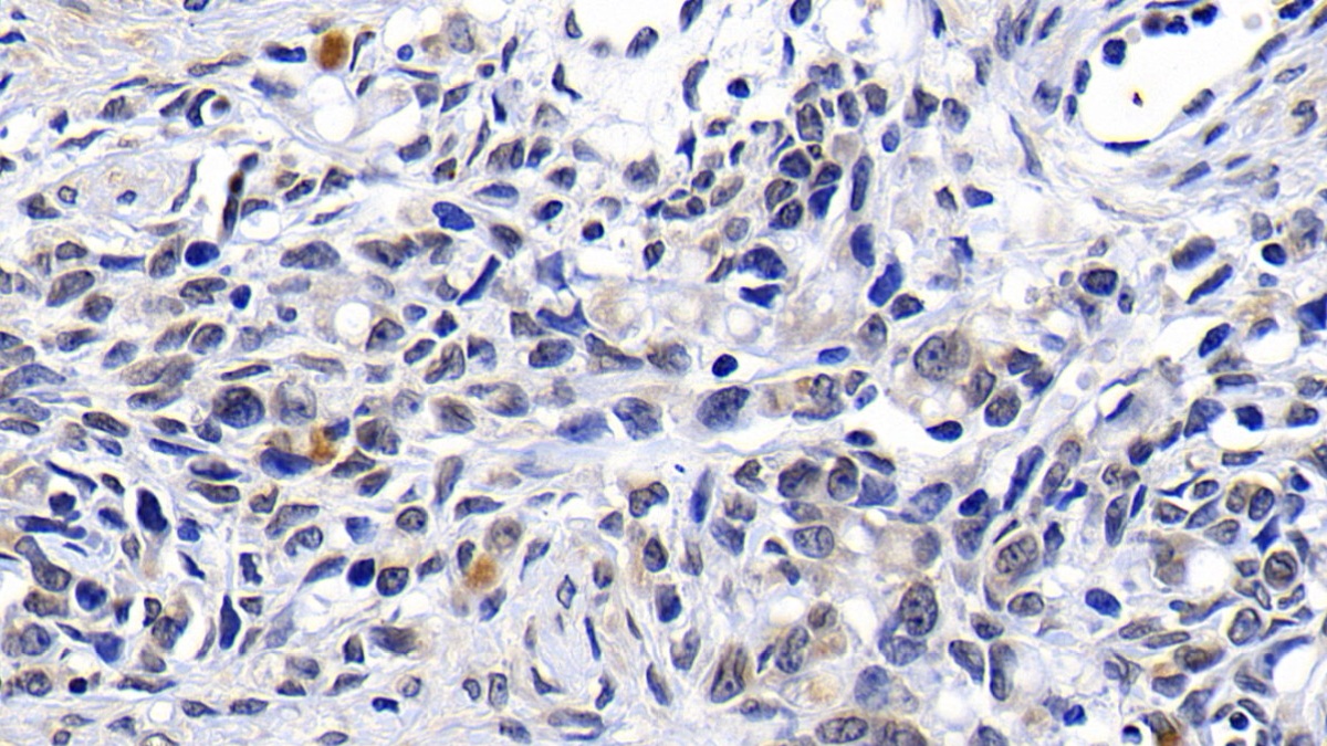 Polyclonal Antibody to Ataxia Telangiectasia Mutated (ATM)