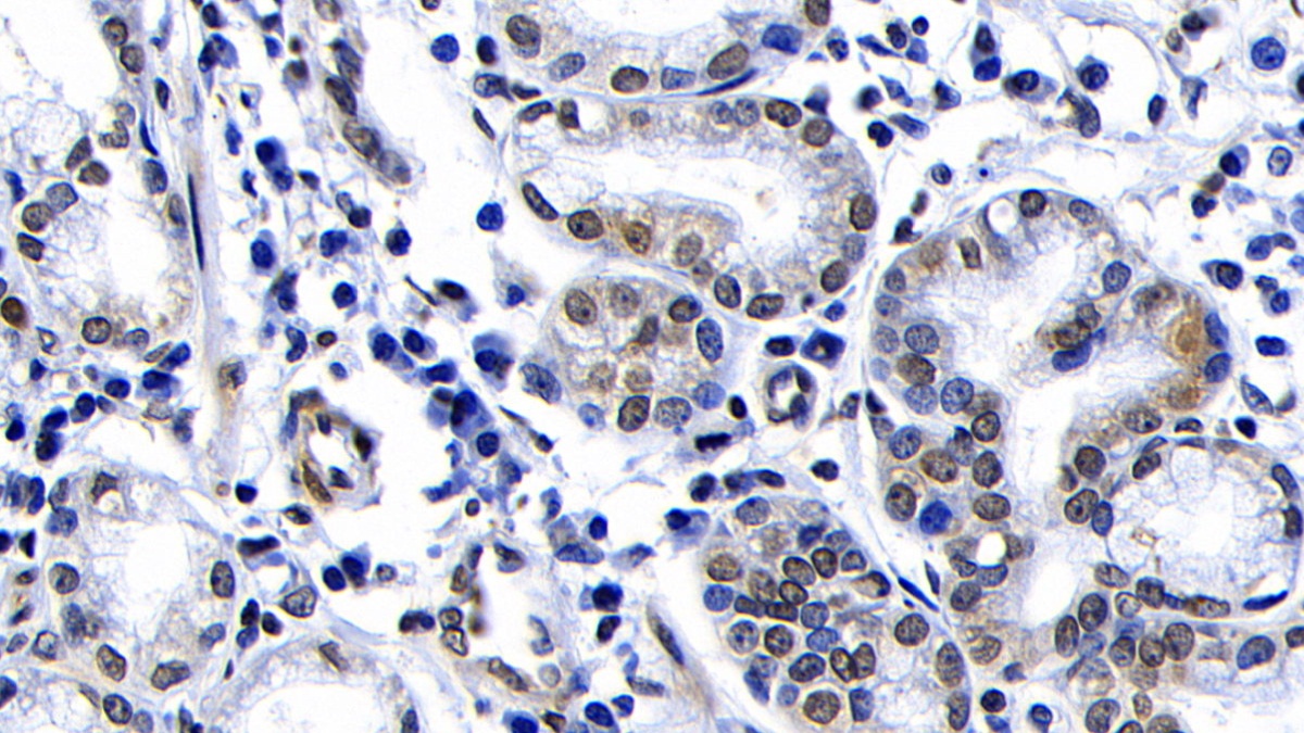 Polyclonal Antibody to Ataxia Telangiectasia Mutated (ATM)