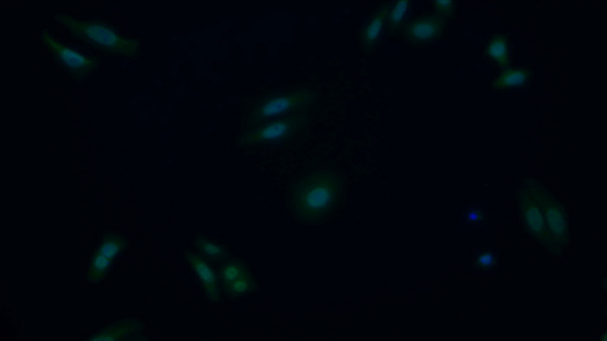 Polyclonal Antibody to Ataxia Telangiectasia Mutated (ATM)