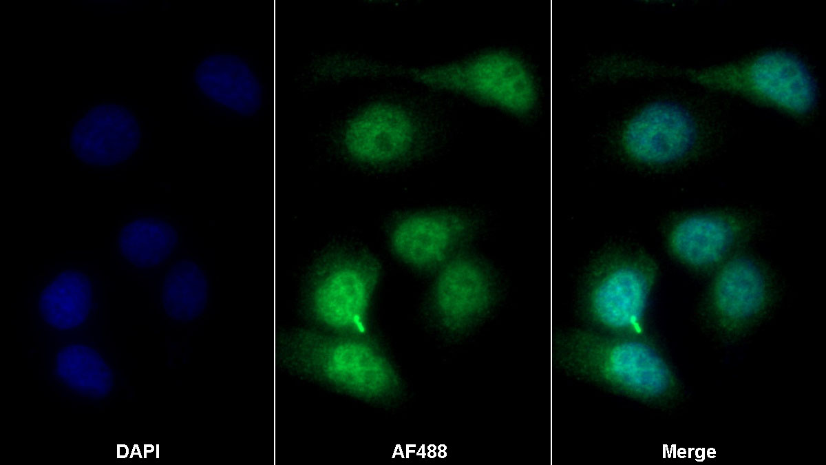 Polyclonal Antibody to Ataxia Telangiectasia Mutated (ATM)