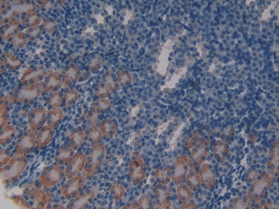 Polyclonal Antibody to Ataxia Telangiectasia Mutated (ATM)