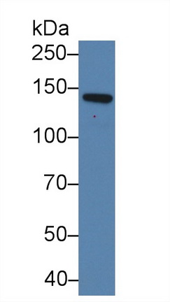 Polyclonal Antibody to Cadherin 5 (CDH5)