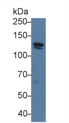 Polyclonal Antibody to Cadherin 5 (CDH5)