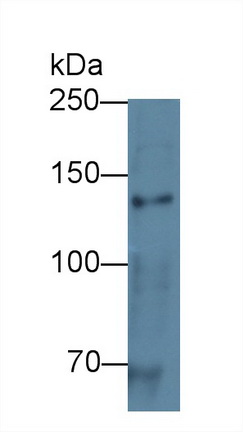 Polyclonal Antibody to Cadherin 5 (CDH5)