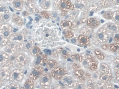 Polyclonal Antibody to Cadherin 5 (CDH5)