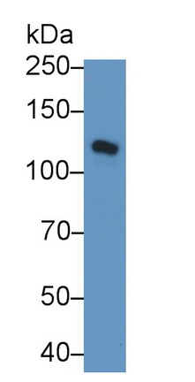 Polyclonal Antibody to Cadherin 5 (CDH5)