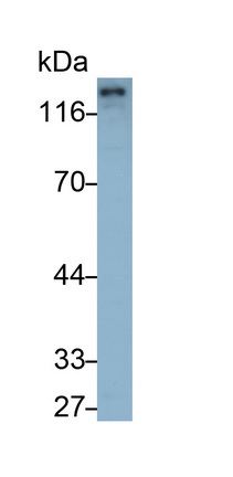 Polyclonal Antibody to Cadherin 5 (CDH5)