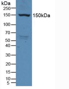 Polyclonal Antibody to Vascular Endothelial Growth Factor Receptor 2 (VEGFR2)