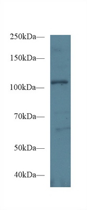 Polyclonal Antibody to Ephrin Type A Receptor 1 (EPHA1)