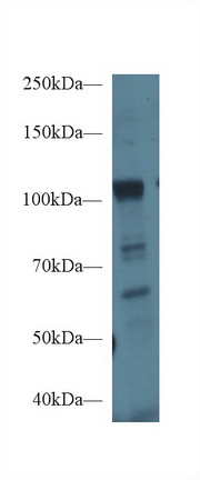 Polyclonal Antibody to Ephrin Type A Receptor 1 (EPHA1)