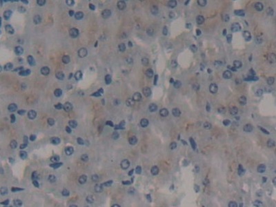 Polyclonal Antibody to Ephrin Type A Receptor 1 (EPHA1)