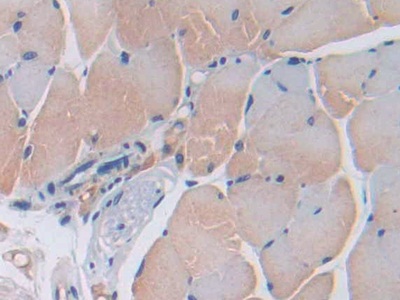 Polyclonal Antibody to Cluster Of Differentiation 74 (CD74)