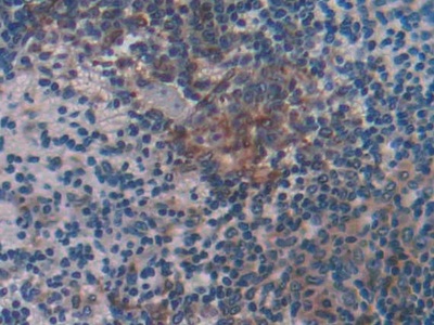 Polyclonal Antibody to Cluster Of Differentiation 74 (CD74)