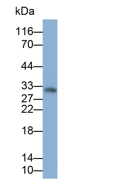 Polyclonal Antibody to Cluster Of Differentiation 74 (CD74)