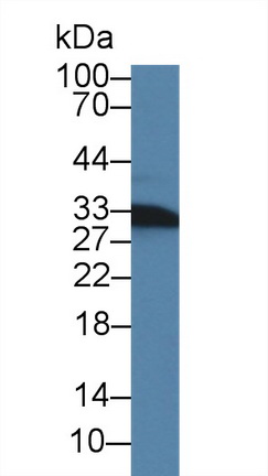 Polyclonal Antibody to Cluster Of Differentiation 74 (CD74)