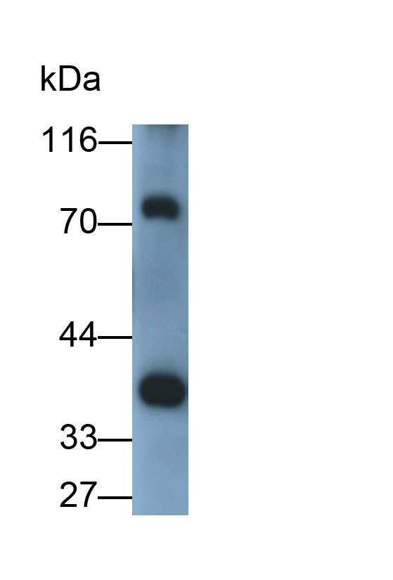 Polyclonal Antibody to Lactate Dehydrogenase A (LDHA)