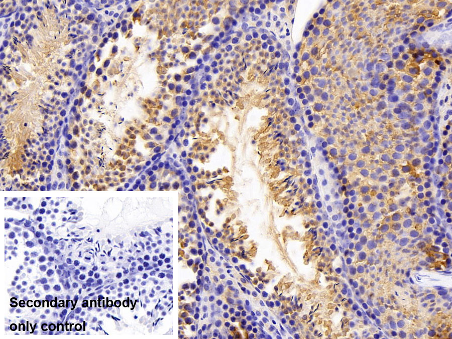 Polyclonal Antibody to Lactate Dehydrogenase A (LDHA)