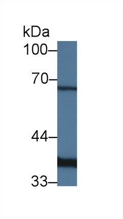 Polyclonal Antibody to Lactate Dehydrogenase A (LDHA)