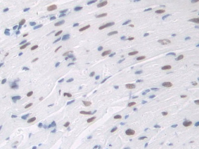 Polyclonal Antibody to Transaldolase (TALDO1)