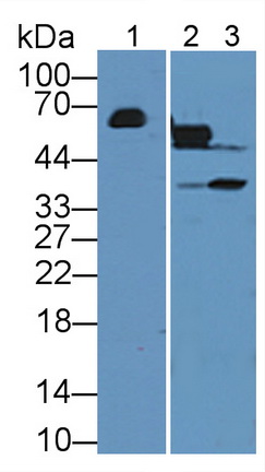 Polyclonal Antibody to Gamma-Glutamyltransferase 1 (gGT1)