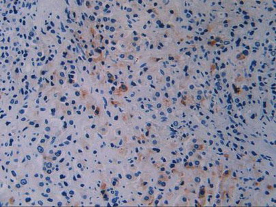 Polyclonal Antibody to Breast Cancer Susceptibility Protein 1 (BRCA1)