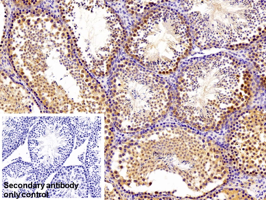 Polyclonal Antibody to Breast Cancer Susceptibility Protein 1 (BRCA1)