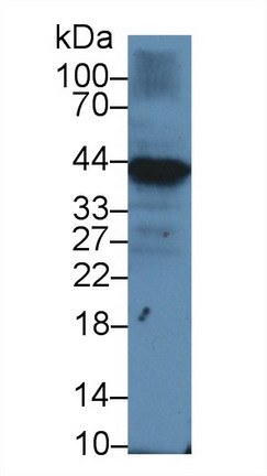 Polyclonal Antibody to Immunoglobulin Associated Alpha (Iga)