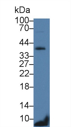 Polyclonal Antibody to Cluster of Differentiation 79B (CD79B)