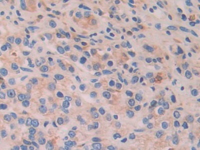 Polyclonal Antibody to Activating Transcription Factor 4 (ATF4)