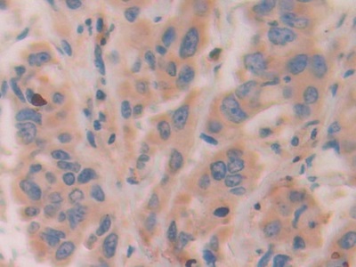 Polyclonal Antibody to Activating Transcription Factor 4 (ATF4)