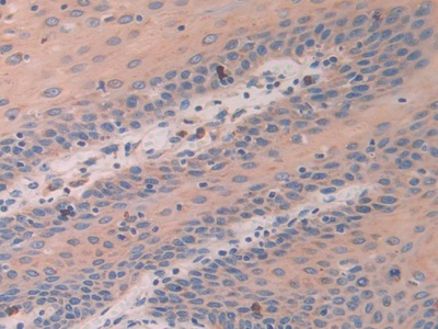 Polyclonal Antibody to Activating Transcription Factor 4 (ATF4)