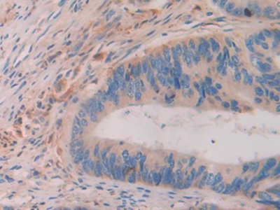 Polyclonal Antibody to Activating Transcription Factor 4 (ATF4)